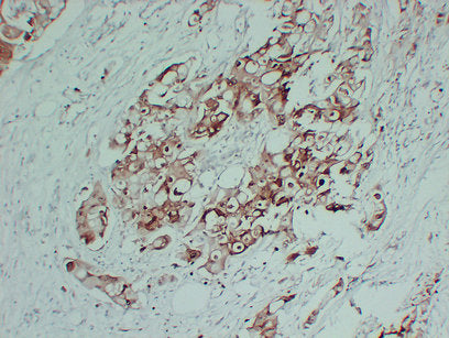Anti-S100P Mouse Monoclonal Antibody
