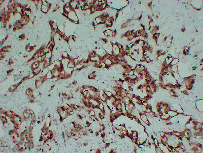 Anti-S100P Mouse Monoclonal Antibody