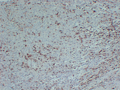 Anti-S100A4 Mouse Monoclonal Antibody