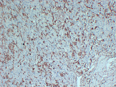 Anti-S100A4 Mouse Monoclonal Antibody