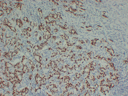 Anti-SOX9 Mouse Monoclonal Antibody