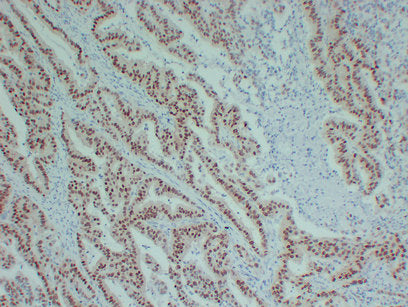 Anti-SOX9 Mouse Monoclonal Antibody