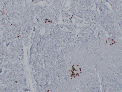Anti-Somatostatin Mouse Monoclonal Antibody