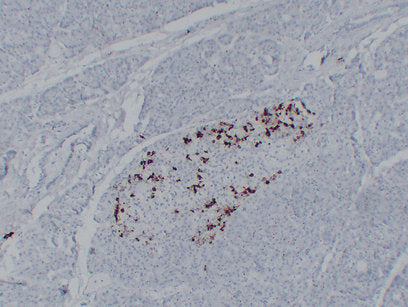 Anti-Somatostatin Mouse Monoclonal Antibody
