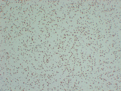 Anti-SMARCB1 Mouse Monoclonal Antibody