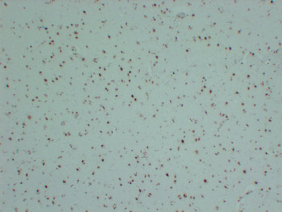 Anti-SMARCB1 Mouse Monoclonal Antibody