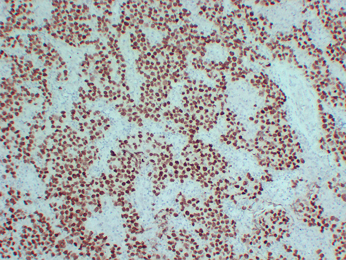Anti-Sall4 Mouse Monoclonal Antibody