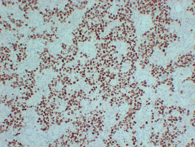 Anti-Sall4 Mouse Monoclonal Antibody