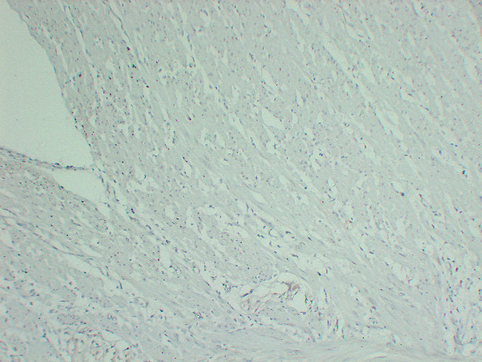 Anti-alpha Skeletal/Cardiac Muscle Actin Mouse Monoclonal Antibody