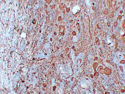 Anti-Thyroglobulin Mouse Monoclonal Antibody