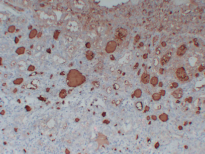 Anti-Thyroglobulin Mouse Monoclonal Antibody