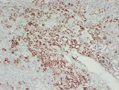 Anti-Thyroid Peroxidase Mouse Monoclonal Antibody