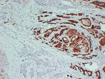 Anti-Thyroid Peroxidase Mouse Monoclonal Antibody