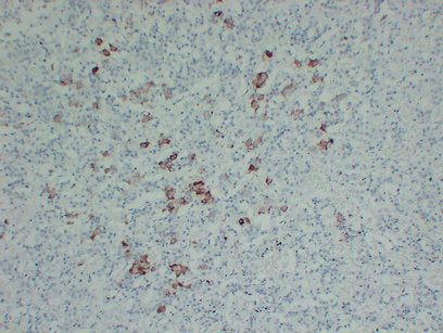 Anti-Thyrotropin Subunit Mouse Monoclonal Antibody