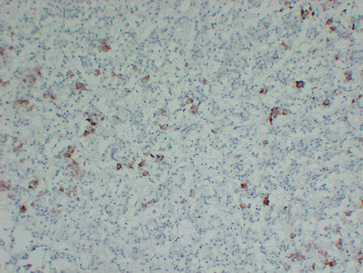Anti-Thyrotropin Subunit Mouse Monoclonal Antibody
