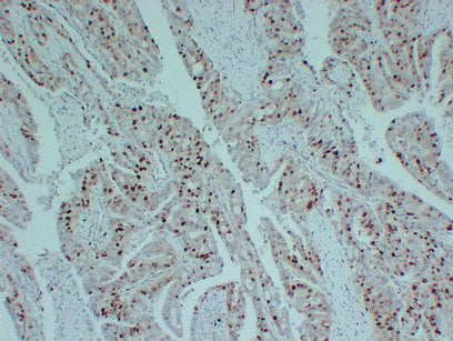 Anti-Topoisomerase II alpha Mouse Monoclonal Antibody