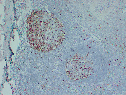 Anti-Topoisomerase II alpha Mouse Monoclonal Antibody
