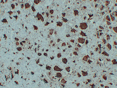 Anti-TR AP Mouse Monoclonal Antibody