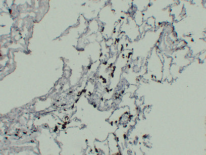 Anti-TR AP Mouse Monoclonal Antibody