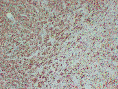 Anti-Tyrosinase Mouse Monoclonal Antibody