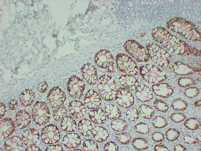 Anti-TGF beta Receptor I Mouse Monoclonal Antibody