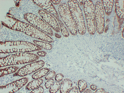 Anti-TGF beta Receptor I Mouse Monoclonal Antibody