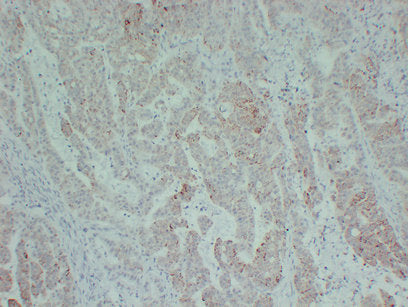 Anti-TGF beta Receptor II Mouse Monoclonal Antibody