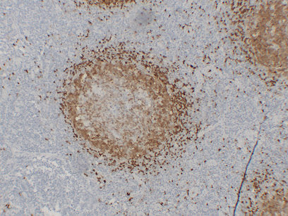 Anti-T Cell Leukemia/Lymphoma Protein 1A Mouse Monoclonal Antibody