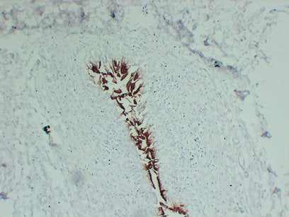Anti-Uroplakin 3A Mouse Monoclonal Antibody
