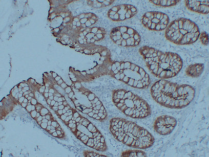 Anti-Villin Mouse Monoclonal Antibody