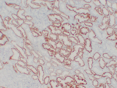 Anti-VHL Mouse Monoclonal Antibody