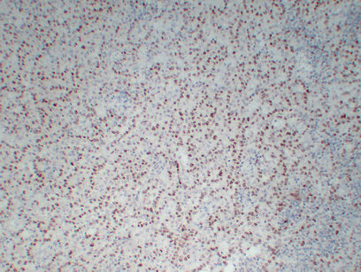 Anti-Wilms Tumor Protein Mouse Monoclonal Antibody