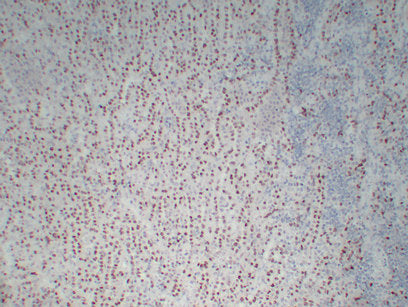Anti-Wilms Tumor Protein Mouse Monoclonal Antibody