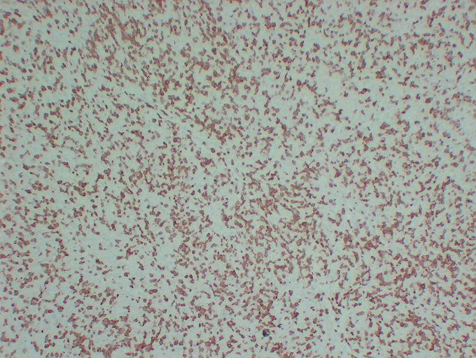 Anti-ZAP70 Mouse Monoclonal Antibody