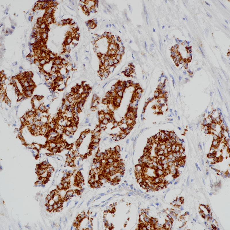 Anti-AMACR Mouse Monoclonal Antibody