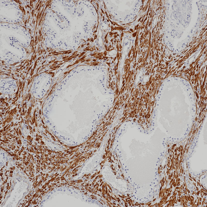 Anti-Desmin Mouse Monoclonal Antibody