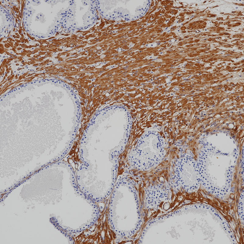 Anti-alpha Smooth Muscle Actin Mouse Monoclonal Antibody