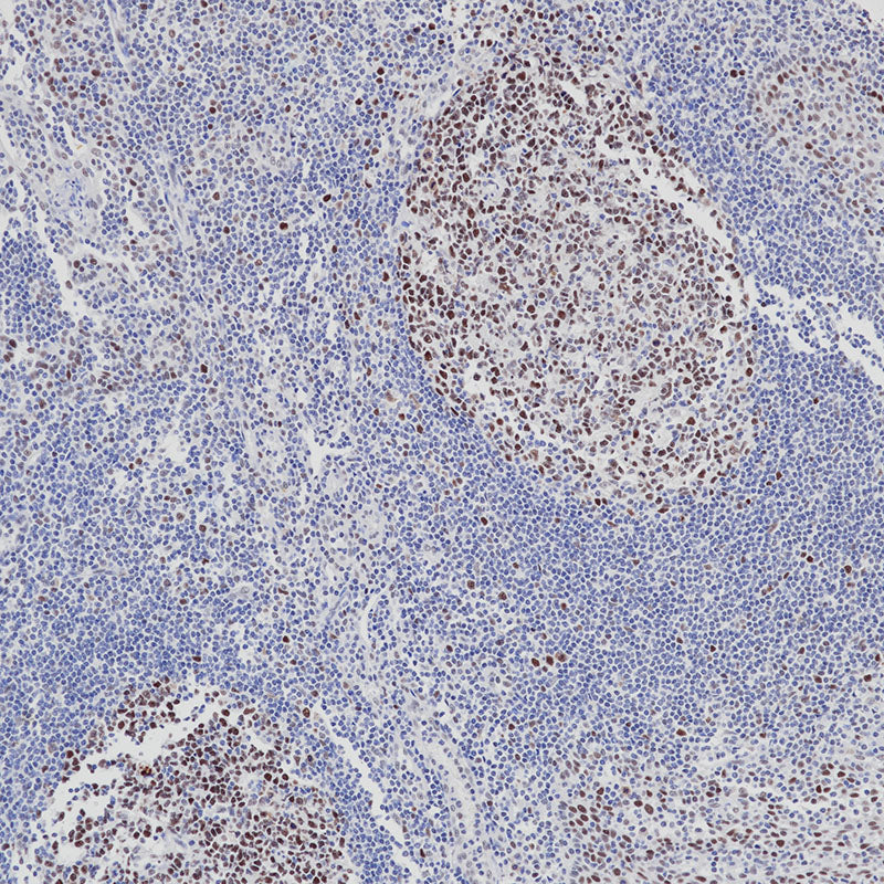 Anti-MSH2 Mouse Monoclonal Antibody