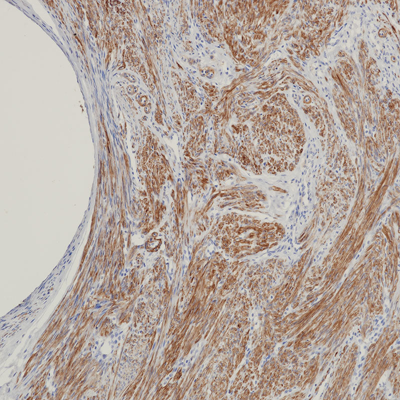 Anti-Caldesmon Mouse Monoclonal Antibody