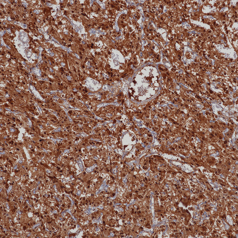 Anti-ENO2 Mouse Monoclonal Antibody