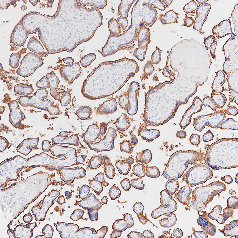 Anti-Placental Alkaline Phosphatase Mouse Monoclonal Antibody