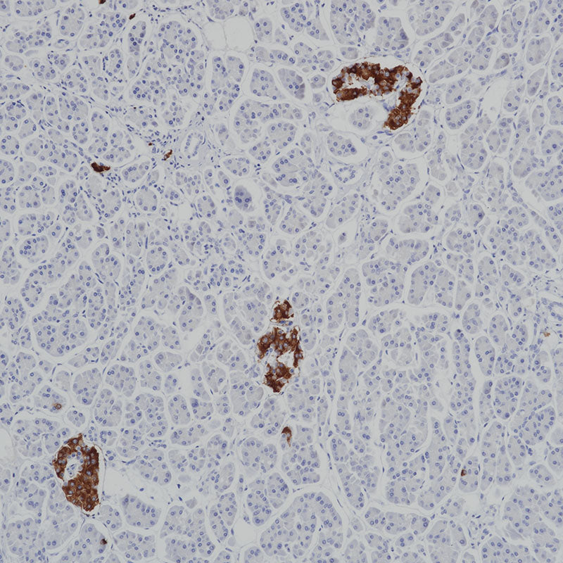 Anti-Insulin Mouse Monoclonal Antibody