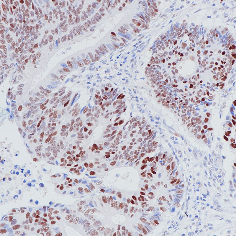 Anti-p53 Mouse Monoclonal Antibody