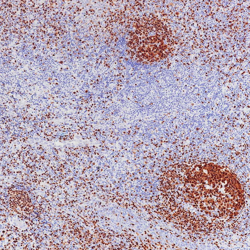 Anti-PAX5 Mouse Monoclonal Antibody
