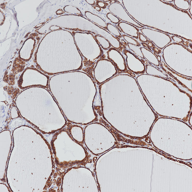 Anti-Thyroid Peroxidase Mouse Monoclonal Antibody