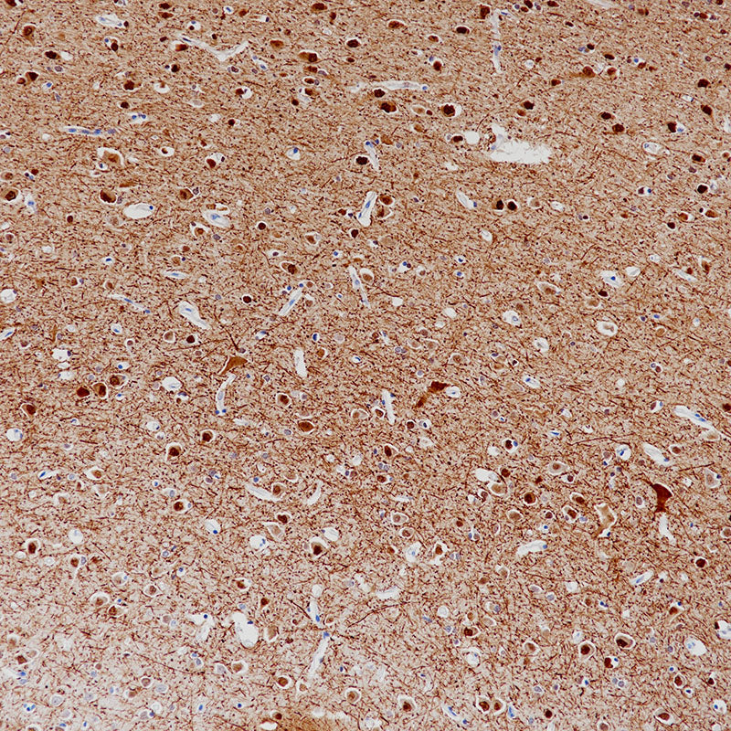 Anti-Neurofilament Mouse Monoclonal Antibody