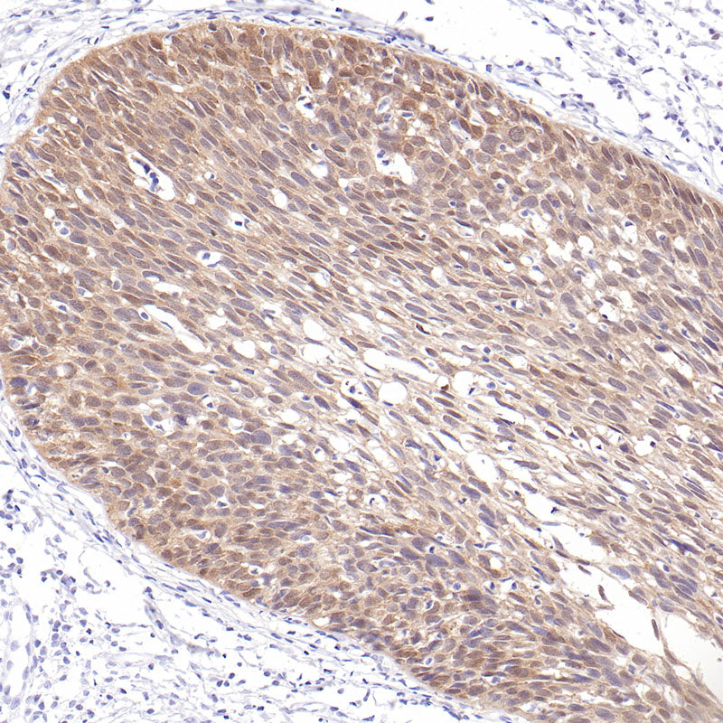 Anti-CDKN2A/p16INK4a Mouse Monoclonal Antibody