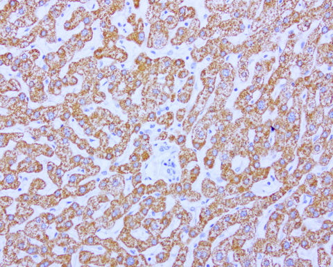 Anti-ABAT Mouse Monoclonal Antibody