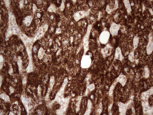 Anti-ABAT Mouse Monoclonal Antibody