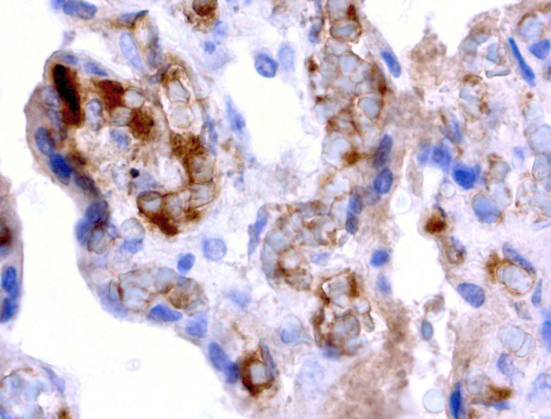 Anti-alpha 1 Fetoprotein Mouse Monoclonal Antibody